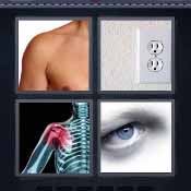 Socket